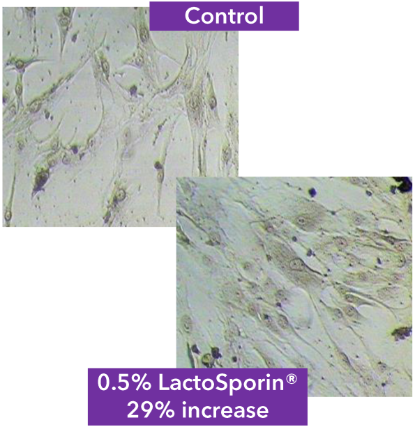 lactosporin